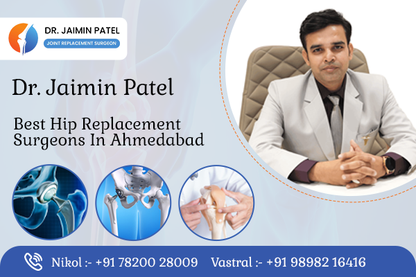 Best Hip Replacement Surgeons in Ahmedabad