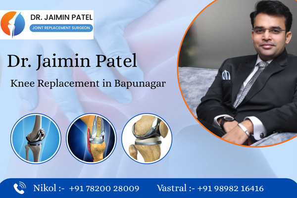 Knee Replacement in Bapunagar