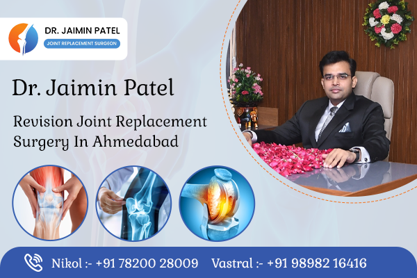 Revision Joint Replacement Surgery in Ahmedabad